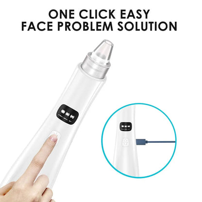 Black Head Remover