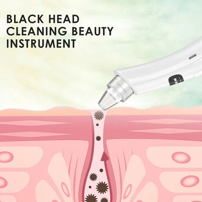 Black Head Remover
